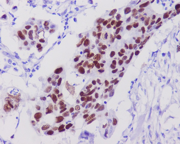 p53 Rabbit mAb Antibody