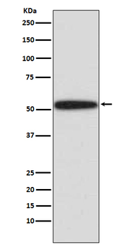 p53 Rabbit mAb Antibody