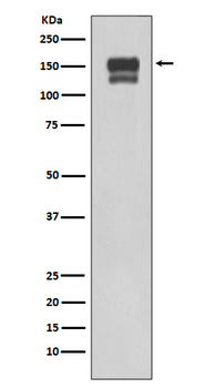 Integrin beta 1 Rabbit mAb [KD Validated] Antibody