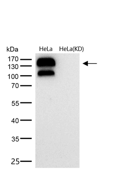 Integrin beta 1 Rabbit mAb [KD Validated]