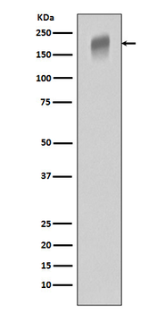VEGF Receptor 1 Rabbit mAb Antibody