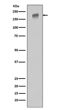 EGFR (ErbB 1) Rabbit mAb [KD Validated] Antibody