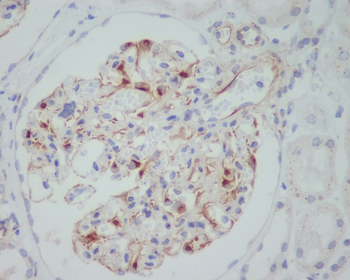 VEGF Rabbit mAb Antibody