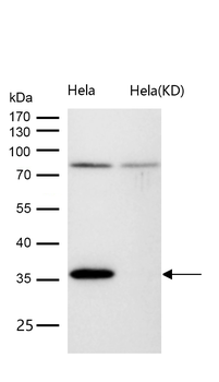 Rad51 Rabbit Monoclonal Antibody