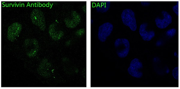 Survivin Rabbit mAb Antibody