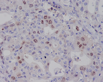 Survivin Rabbit mAb Antibody