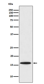 Survivin Rabbit mAb Antibody