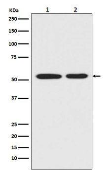 Mutant p53 Rabbit mAb Antibody