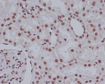 Cleaved PARP Rabbit mAb Antibody