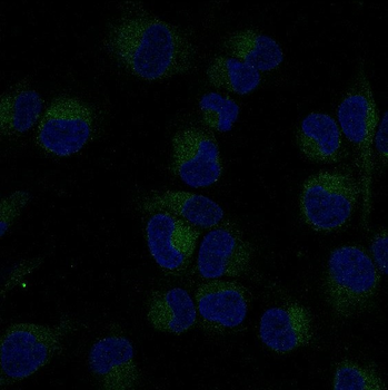 NF-κB p65 Rabbit mAb [KD Validated] Antibody