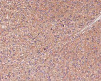NF-κB p65 Rabbit mAb [KD Validated] Antibody