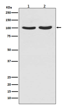 Androgen Receptor Rabbit mAb [KD Validated] Antibody