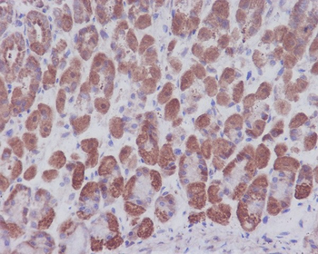 IKB alpha Rabbit mAb Antibody