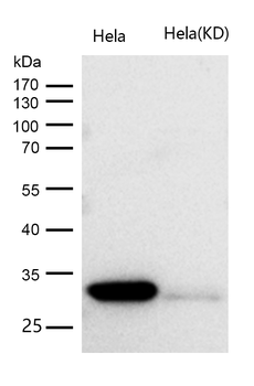 CDK2 Rabbit Monoclonal Antibody