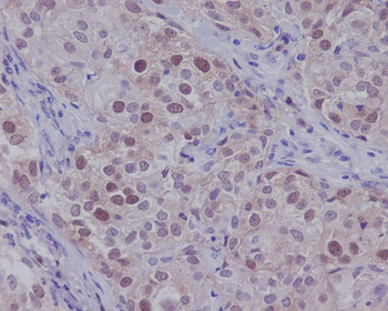 CDK2 Rabbit Monoclonal Antibody
