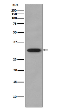 CDK2 Rabbit Monoclonal Antibody
