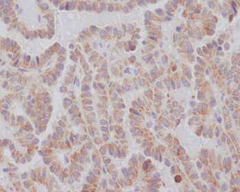 KIFC1 Rabbit mAb Antibody
