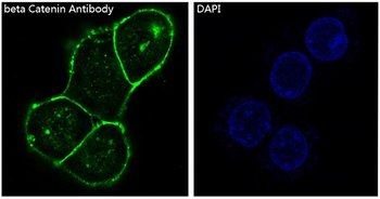 beta Catenin Rabbit mAb Antibody
