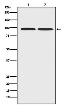 beta Catenin Rabbit mAb Antibody