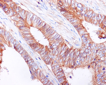 E Cadherin Rabbit mAb Antibody