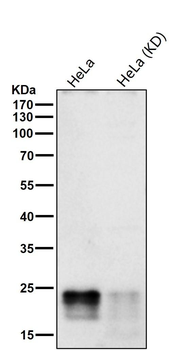 eIF4EBP1/2/3 (Phospho-Thr32/T46) Antibody