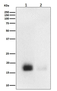 eIF4EBP1/2/3 (Phospho-Thr32/T46) Antibody