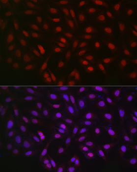 LKB1 Rabbit pAb