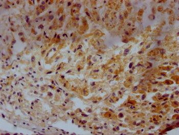 CD63 Antibody