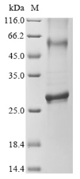 Recombinant Human Cyclin-dependent kinase 5 activator 1 (CDK5R1), partial