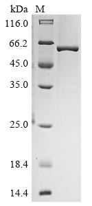 Recombinant Human Noggin (NOG)