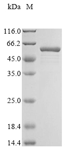 Recombinant Human Annexin A5 (ANXA5)