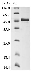 Recombinant Human coronavirus 229E Nucleoprotein (N)