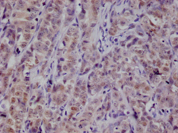 PKN2 Antibody