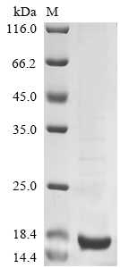 Simian virus 40 SV40 early leader Protein