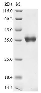 Simian virus 40 SV40 early leader Protein