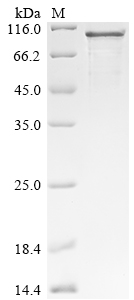Human TIPARP Protein