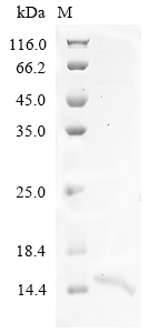 Human ANK3 Protein