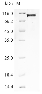 Human TIPARP Protein
