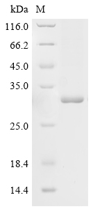 Human AK7 Protein