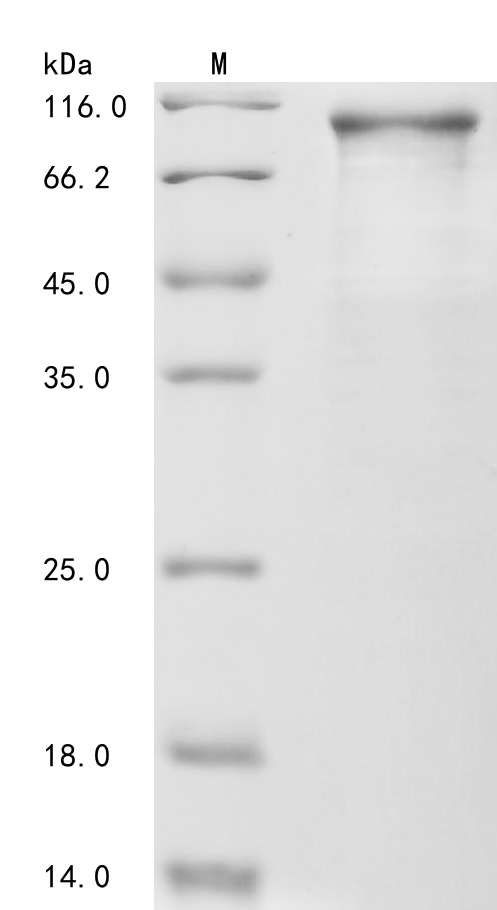 Human CTNNB1 Protein