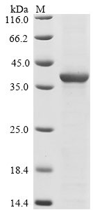 Human CDK5 Protein