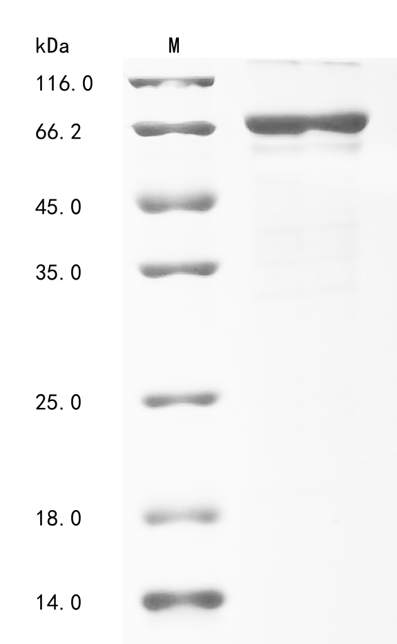 Human IGF2BP1 Protein