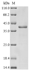 Human ITGB7 Protein