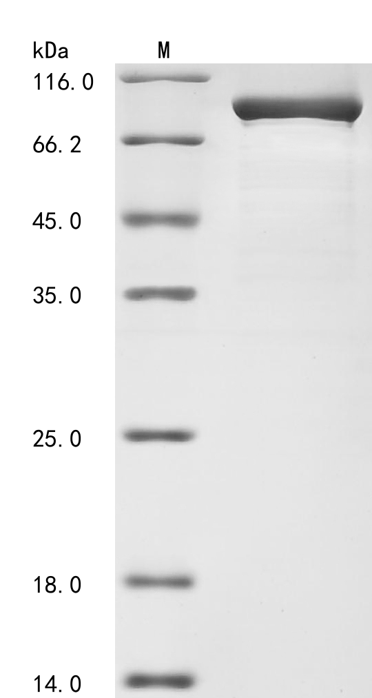 Human AK7 Protein