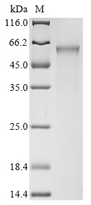 Human Cellular tumor antigen p53 Protein