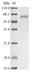 Human Cellular tumor antigen p53 Protein