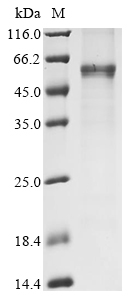 Human Cellular tumor antigen p53 Protein