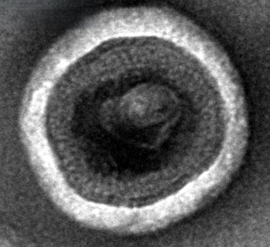 Human CLDN6-VLPs Protein