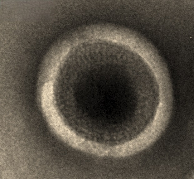 Human MS4A1-VLPs Protein
