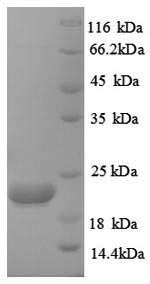 Human CASP8 Protein